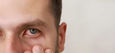 Ocular-Emergencies