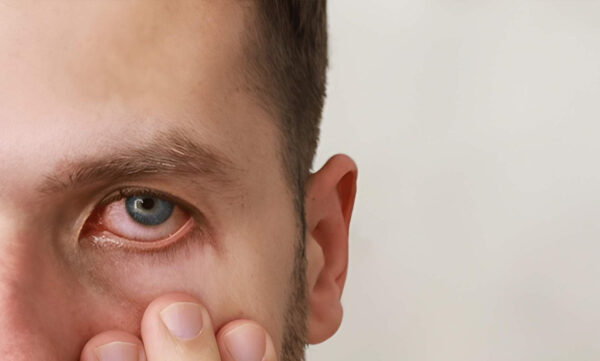 Ocular-Emergencies